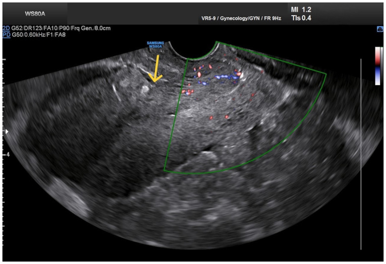 Figure 6