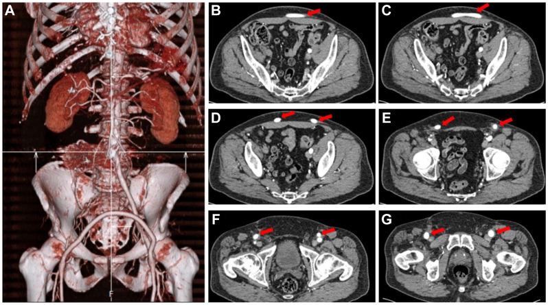 Figure 6