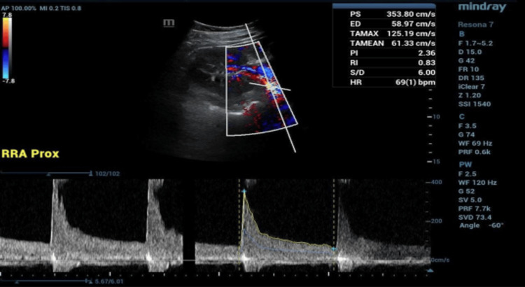 Figure 2