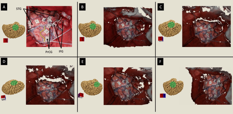 Figure 4