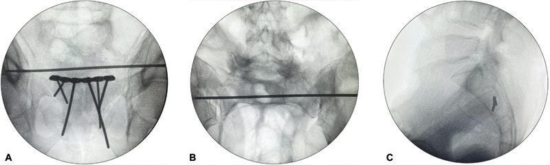 Fig. 5