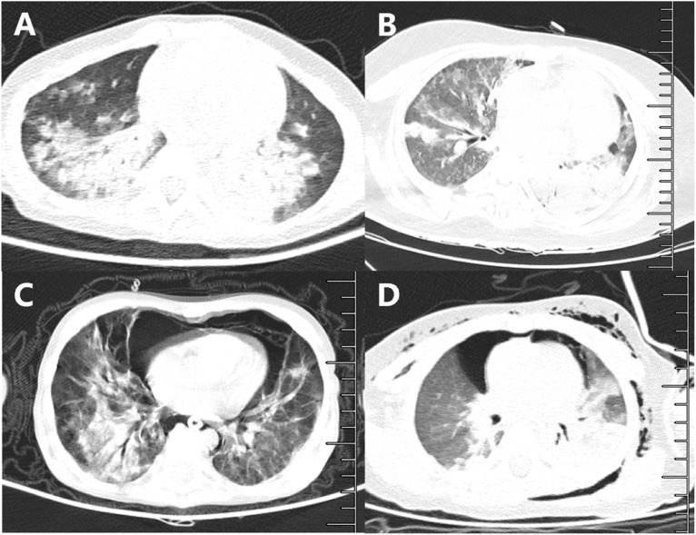 Figure 2