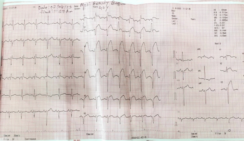 Figure 5