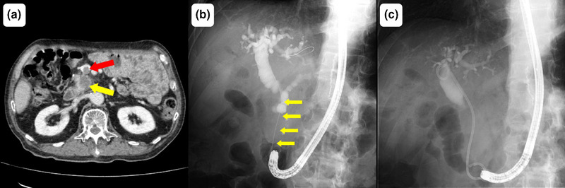 FIGURE 1