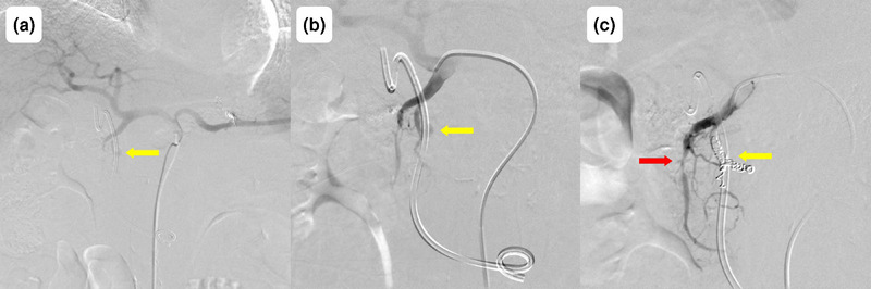 FIGURE 4