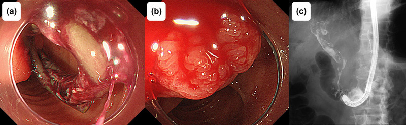 FIGURE 3