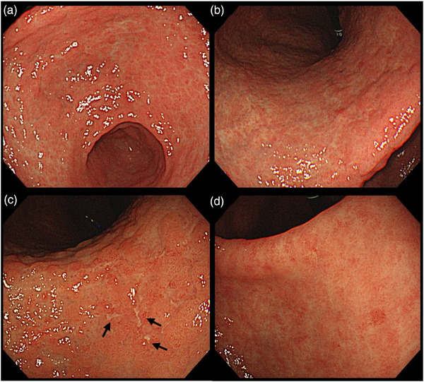 FIGURE 4