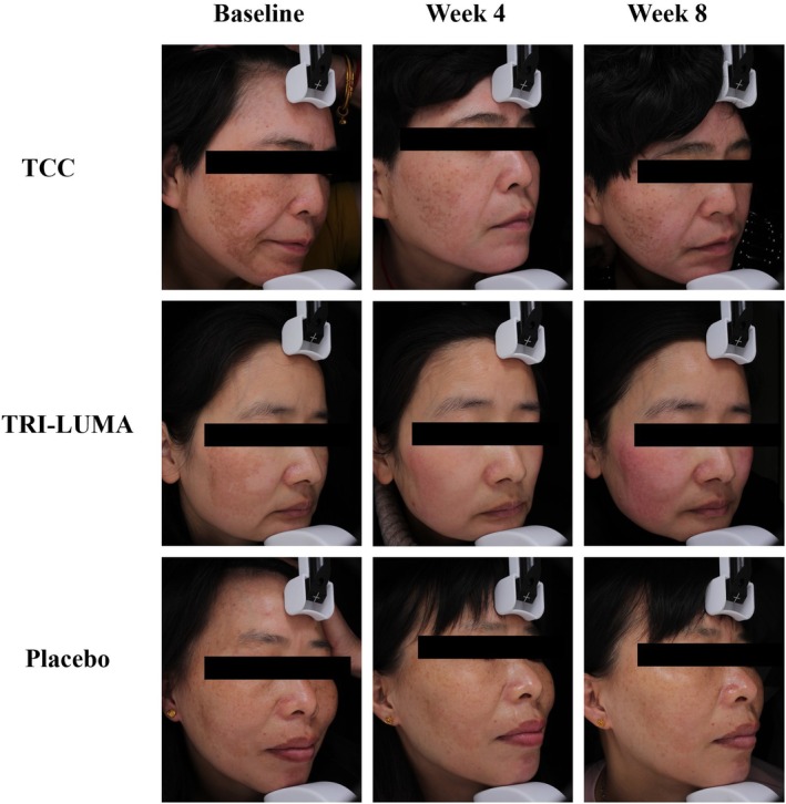 FIGURE 4