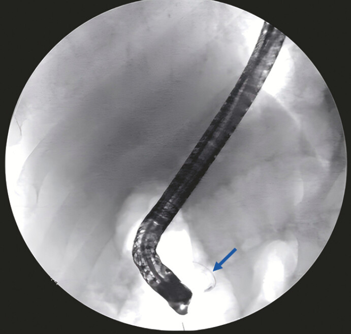 Fig. 1