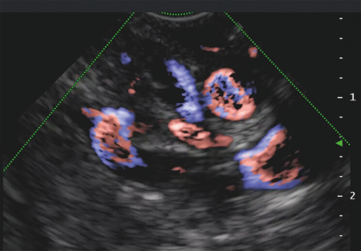 Fig. 3