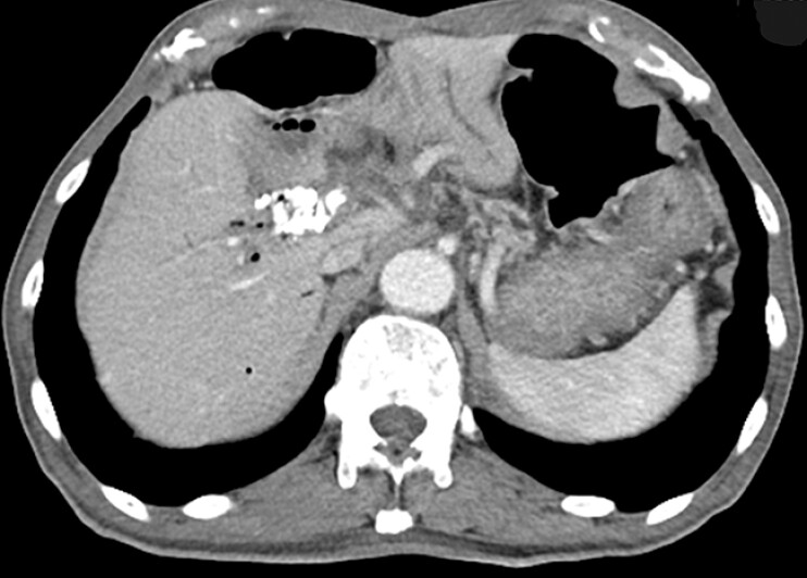 Fig. 5