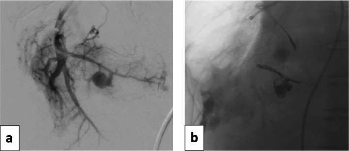 FIGURE 1