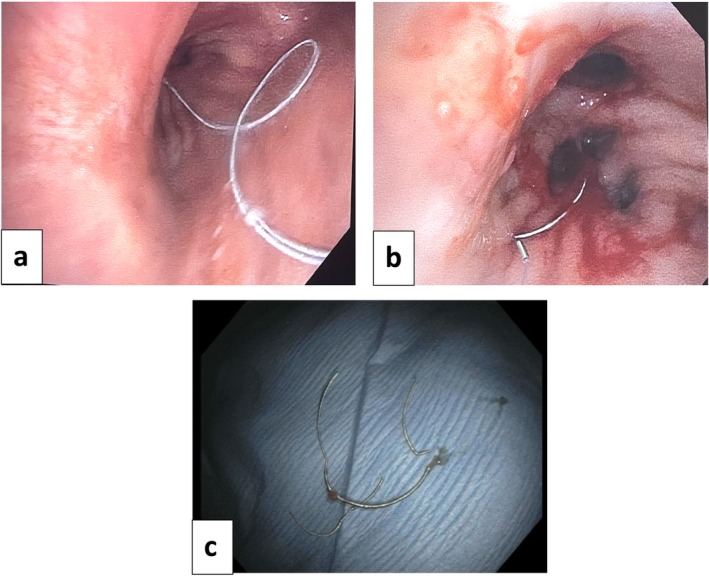 FIGURE 3