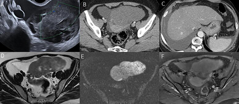 FIG. 1
