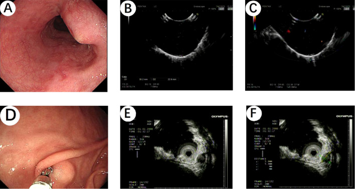 Figure 2
