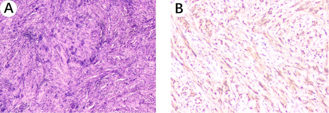 Figure 4