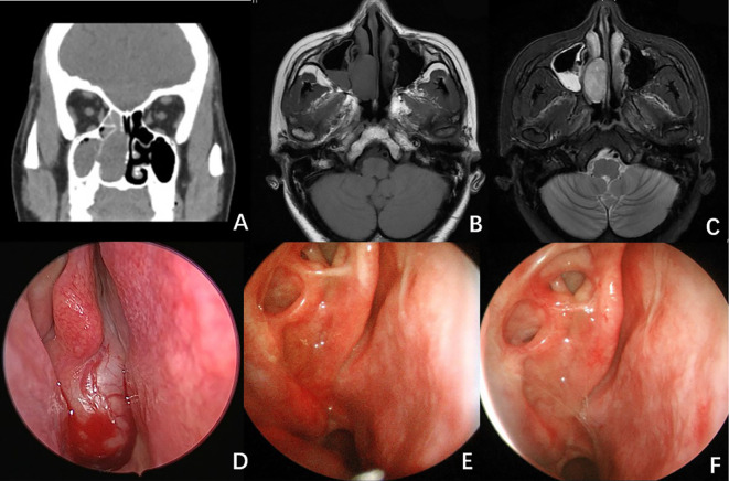 Figure 1