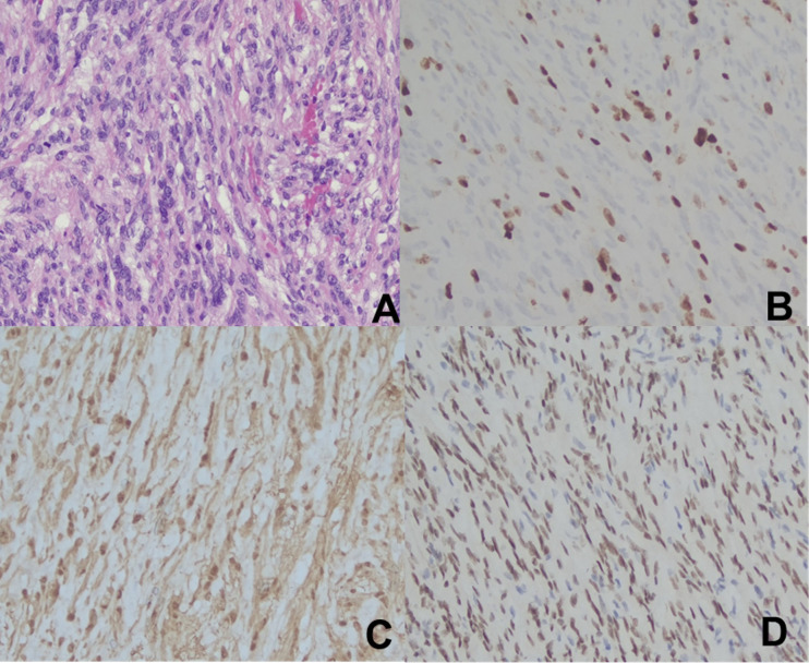 Figure 2
