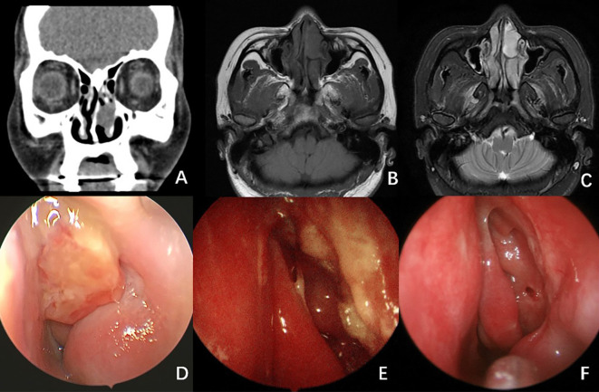 Figure 3