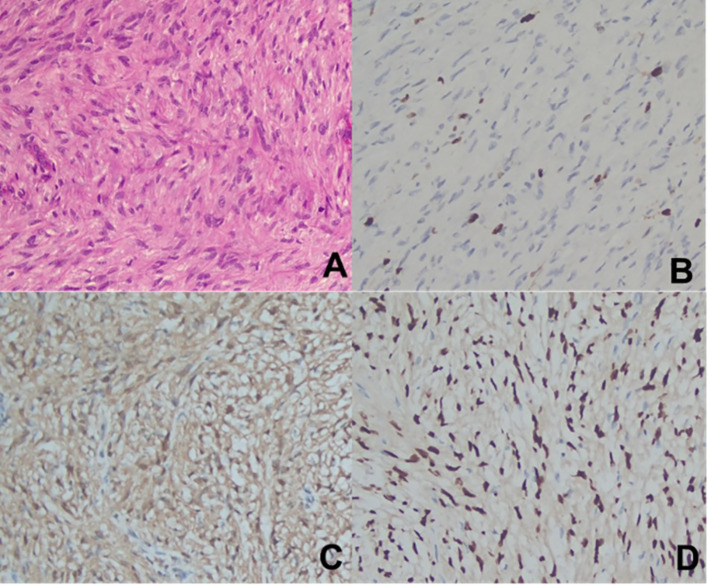 Figure 4
