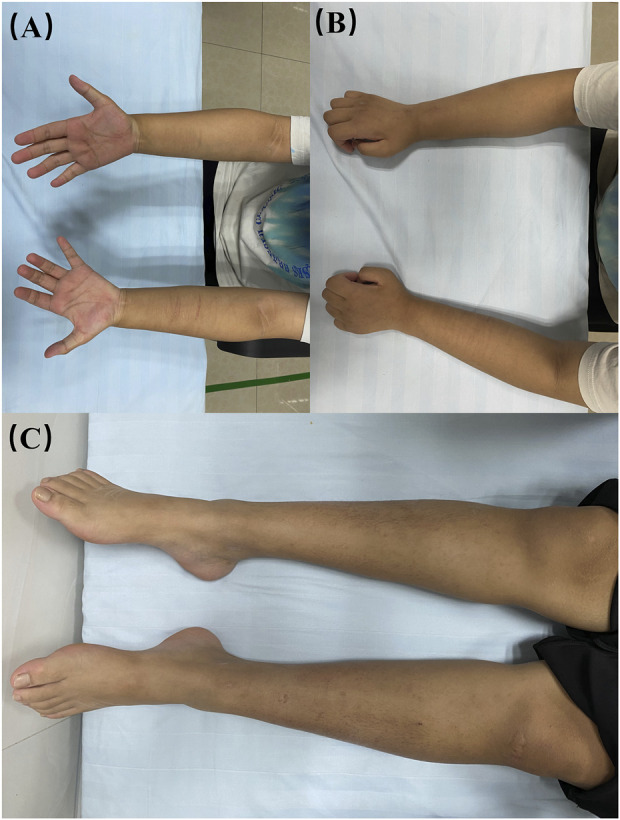 FIGURE 3