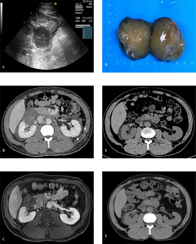 Figure 1