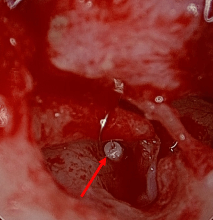 Figure 7