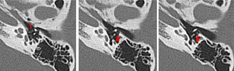 Figure 11