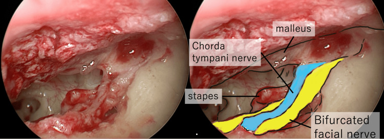 Figure 13