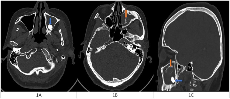 Figure 1