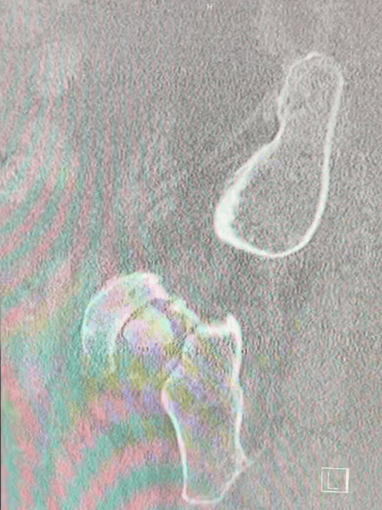 Figure 5