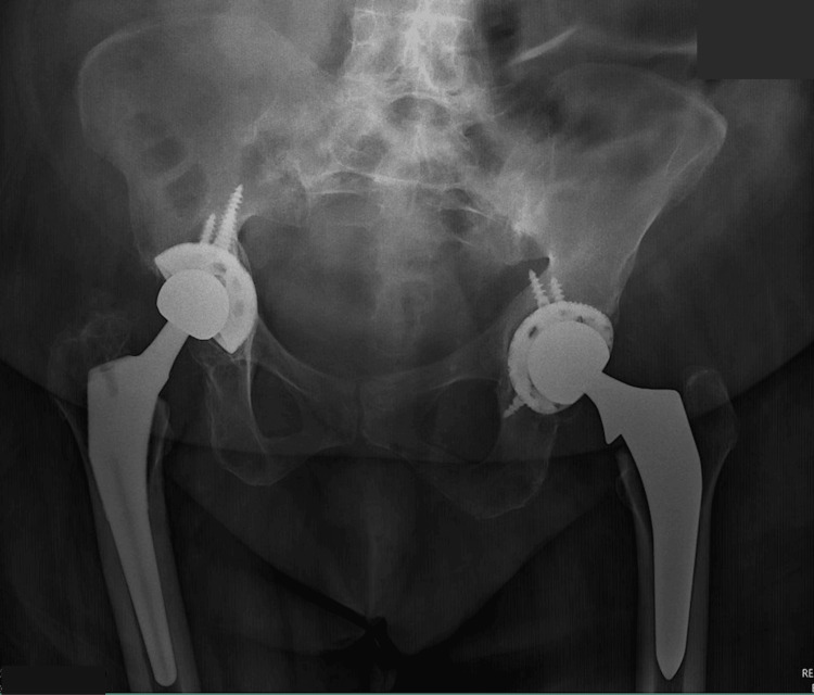 Figure 6