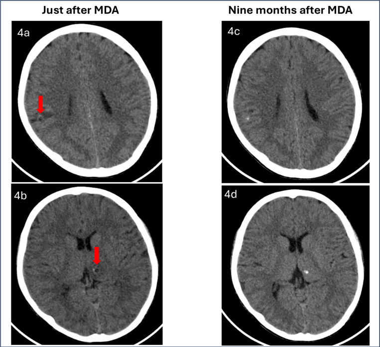 Fig 4