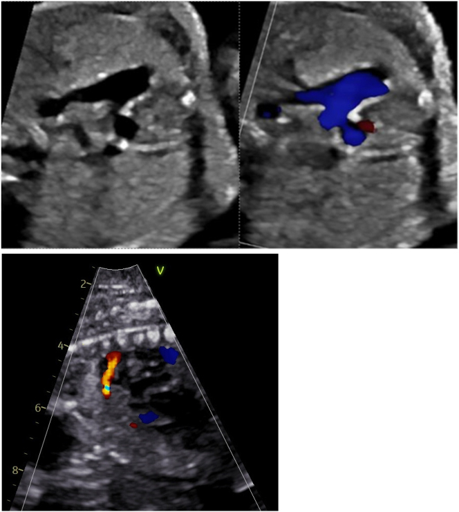Figure 2