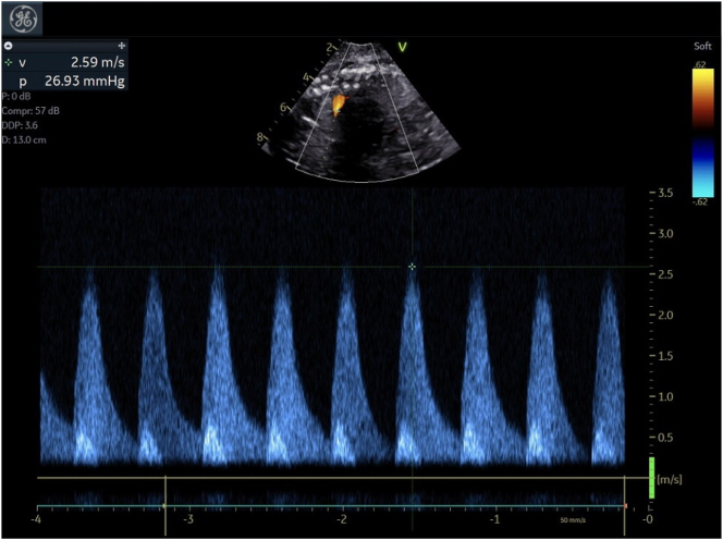 Figure 3