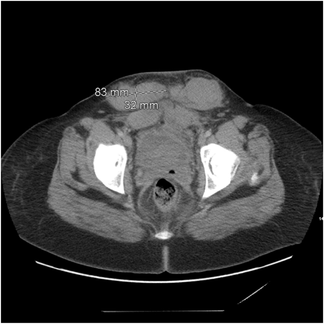 Figure 2