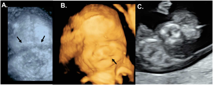 Figure 1