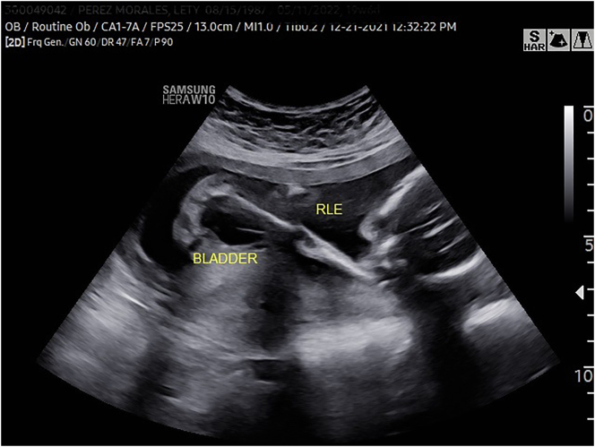Figure 1