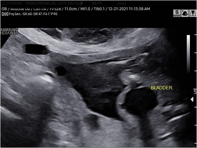 Figure 3