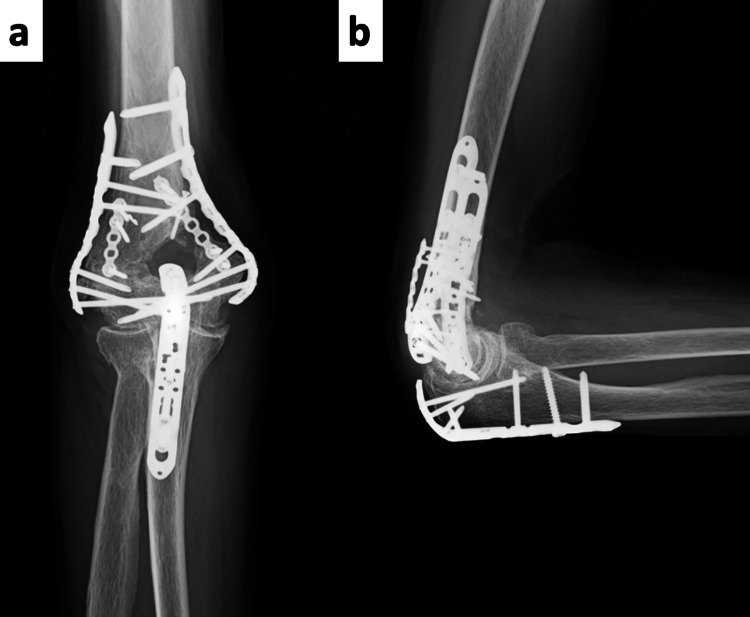 Figure 6
