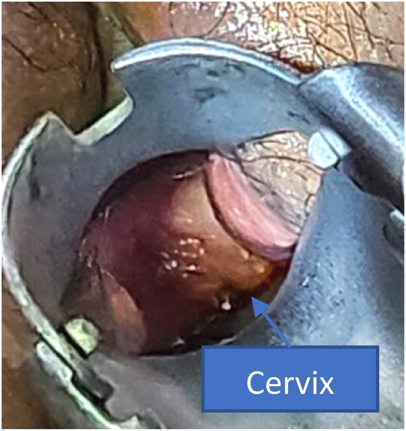 Figure 5