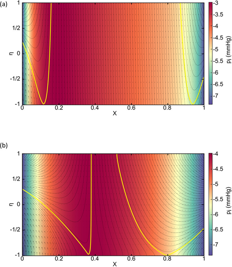 Figure 45