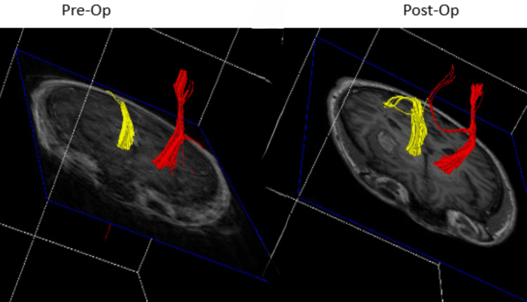 Figure 12
