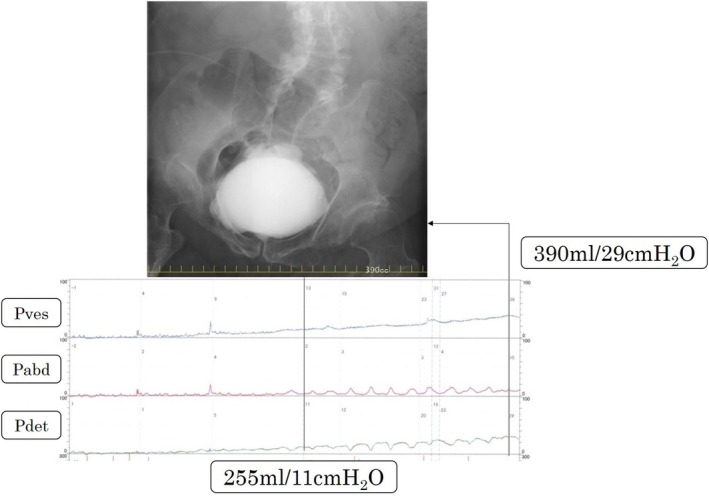 FIGURE 4