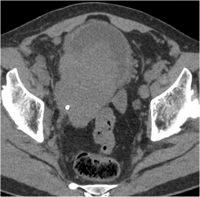 FIGURE 3