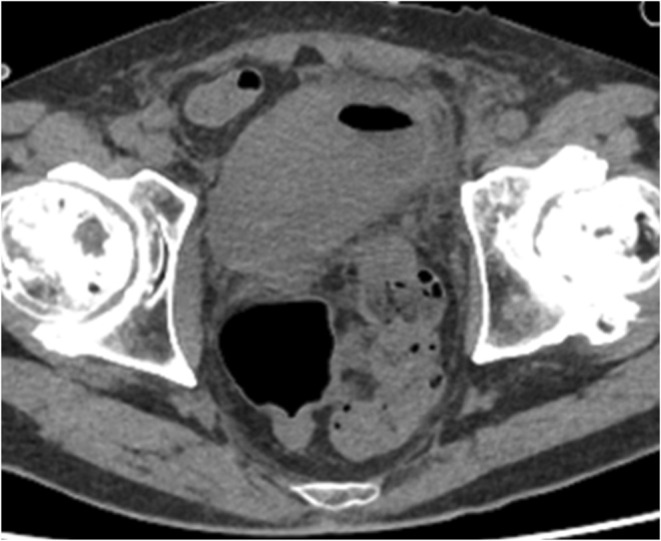 FIGURE 4