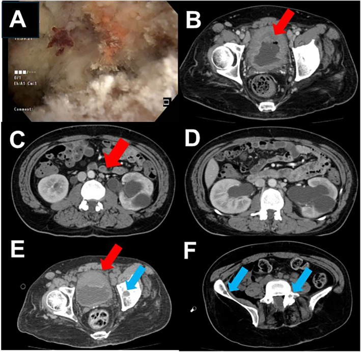 FIGURE 1