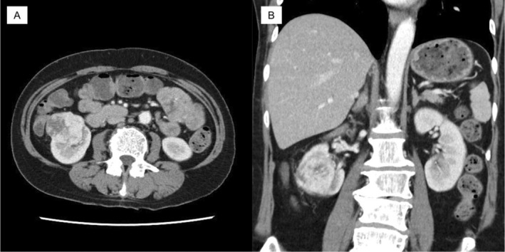 FIGURE 2