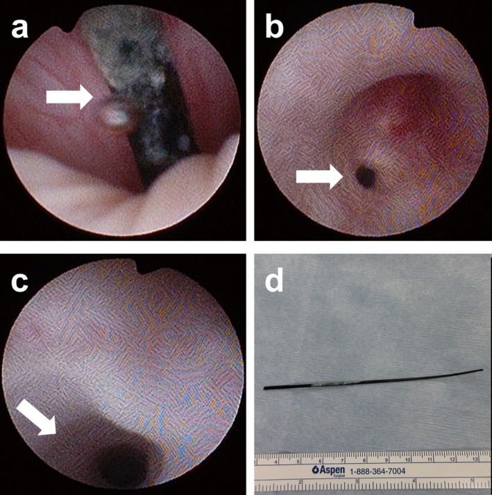 FIGURE 3