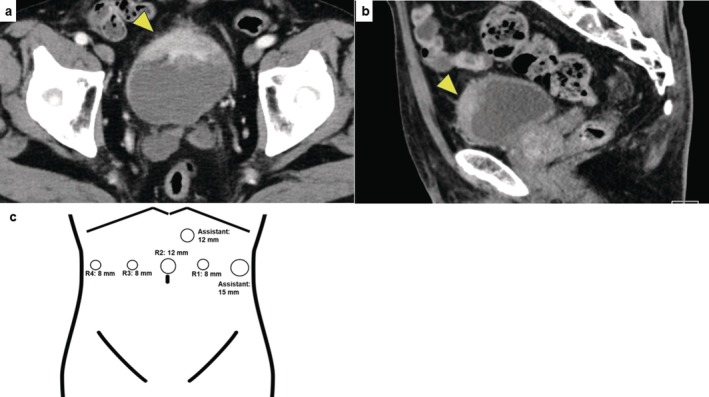 FIGURE 1
